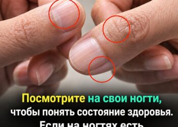 Ногти могут рассказать о вашем здоровье больше