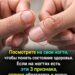 Ногти могут рассказать о вашем здоровье больше