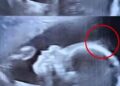 Малышка родилась с роскошными волосами и покорила мир